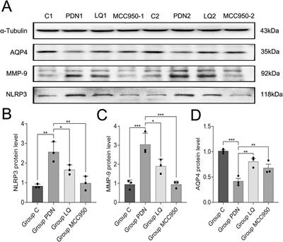 Liquiritin ameliorates painful diabetic neuropathy in SD rats by inhibiting NLRP3-MMP-9-mediated reversal of aquaporin-4 polarity in the glymphatic system